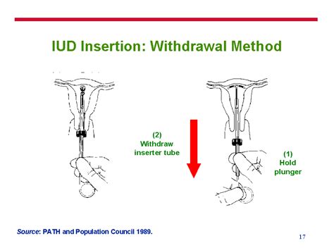 How Withdrawal Method 的图像结果