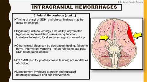 Neonatal Intracranial Hemorrhage - by dr. Sonali Mhatre | PPTX