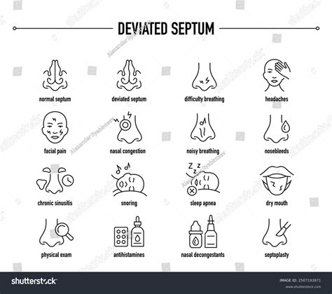 Deviated Septum Symptoms Diagnostic Treatment Vector Stock Vector (Royalty Free) 2507193971 ...