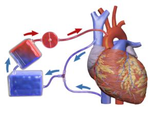 Need for caution-Dexmedetomidine clearance low during Cardiopulmonary ...