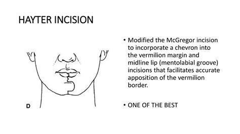 Lip splitting incisions | PPT