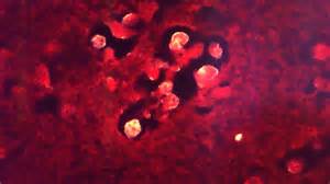 Where do 'brain-eating amoebas' live? Here's where they're found in NC