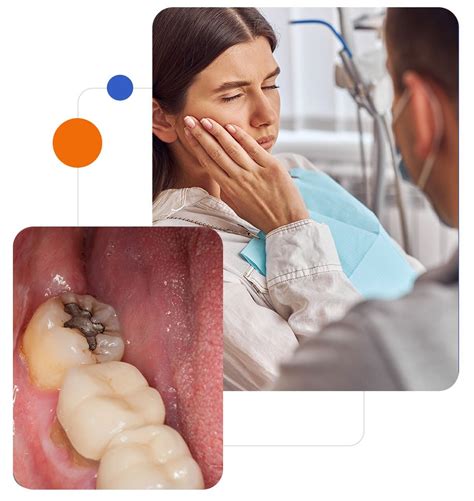 Image result for Remove Wisdom Teeth