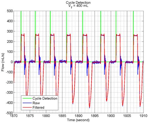 Image result for Python Cycle Detection Grid