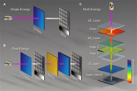 Layers Of X Ray