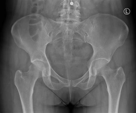 Diagnostics: Knee and Ankle X-rays — Taming the SRU