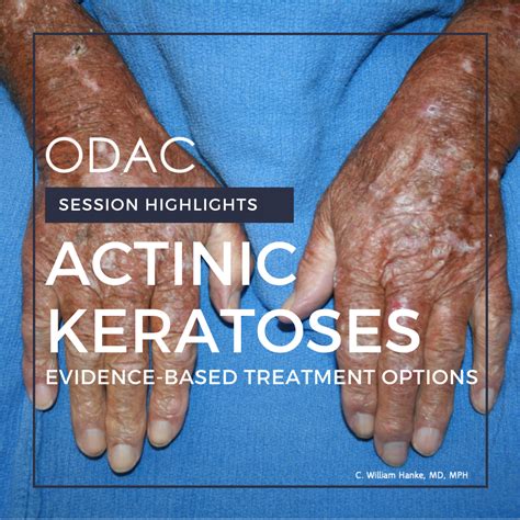 What Color Is Actinic Keratosis Cream - Infoupdate.org