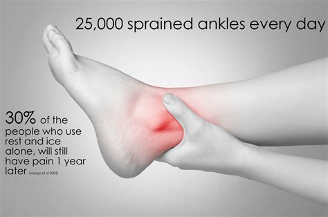 What Is A Grade 3 Ankle Sprain at Aron Desrochers blog