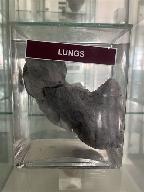 LUNG | NAMO Medical Education & Research Institute
