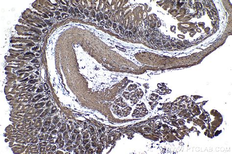 IHCeasy SULF2 Ready-To-Use IHC Kit KHC1231 | Proteintech