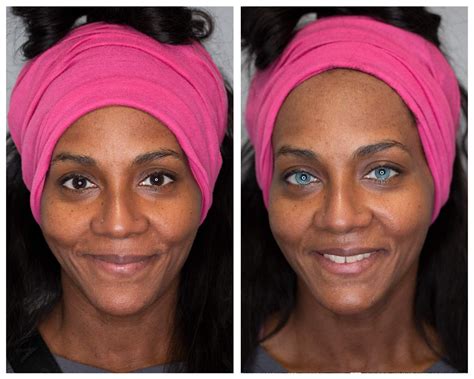 Image result for Eye Color Change Procedure