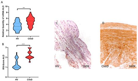 Venous Wall of Patients with Chronic Venous Disease Exhibits a ...