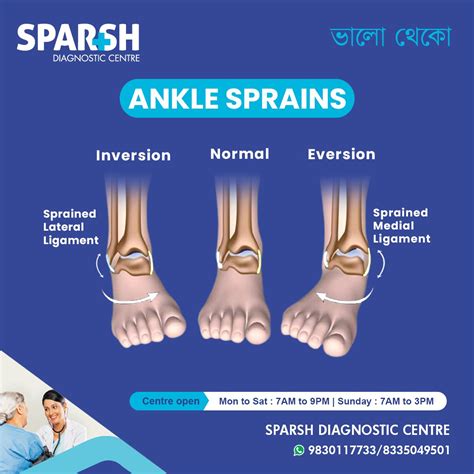 Ankle Sprains - Sparsh Diagnostic Center