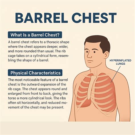 Barrel Chest: What is it and What Does it Mean for COPD?