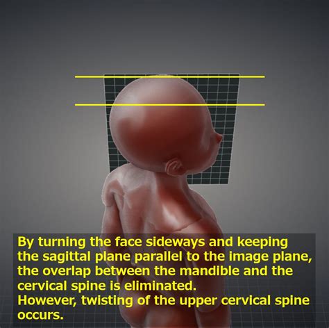 Image result for Contralateral View