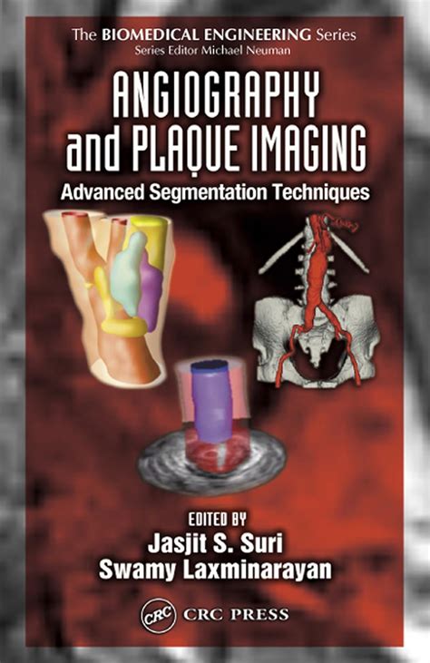 Angiography and Plaque Imaging: Advanced Segmentation Techniques ...