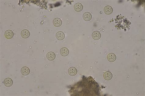 Entamoeba Histolytica – アメーバ赤痢 画像 – KRCTV