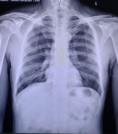 Patient Detail