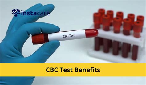 Complete Blood Count: Various CBC Test Benefits