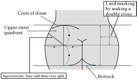 Image result for Injection Sites