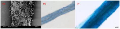 Unraveling the Interaction between Arbuscular Mycorrhizal Fungi and ...