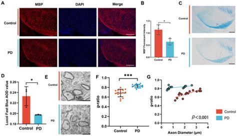 Oligodendrocyte-Specific STAT5B Overexpression Ameliorates Myelin ...