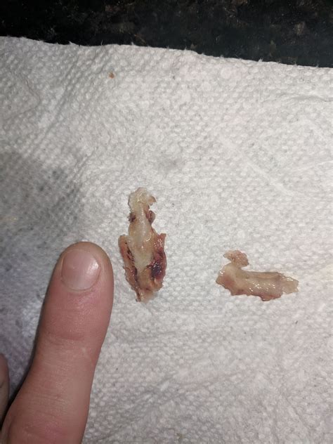 So i blew this out yesterday, nasal polyps? : popping