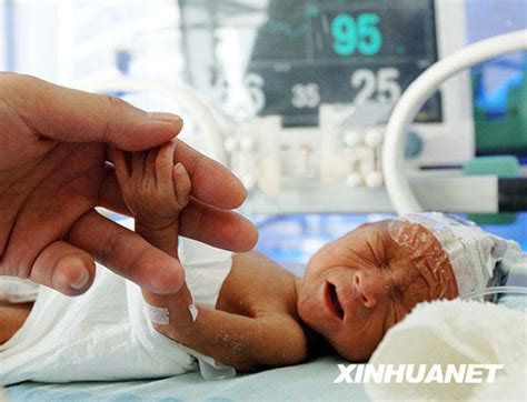 组图：重庆胎龄六个月早产儿成功存活_新闻中心_新浪网