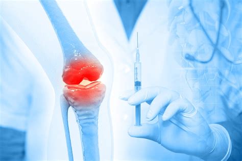 Stem Cell Procedure for Knees: Can It Heal Cartilage?