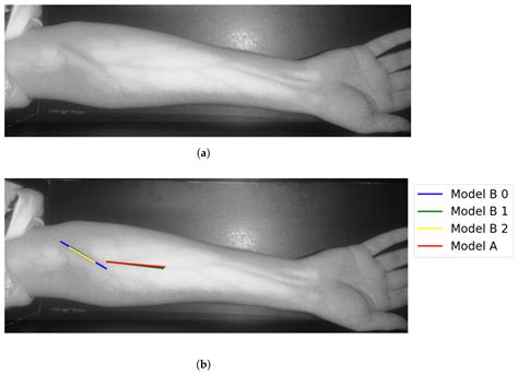 Forearm Intravenous Detection and Localization for Autonomous Vein ...