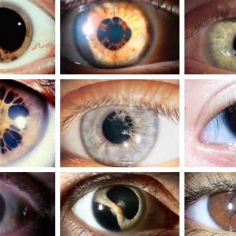 Image result for Iris Recognition Using MATLAB Source Code
