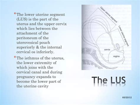Lower uterine segment | PPT - isthmus of uterus