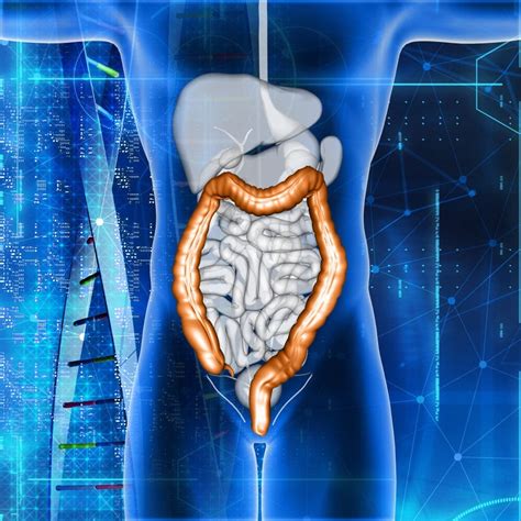 What Is Crohn's Disease? – MyDiagnostics