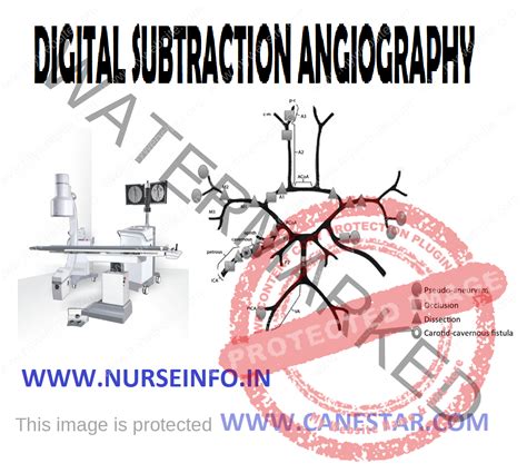 DIGITAL SUBTRACTION ANGIOGRAPHY - Nurse Info