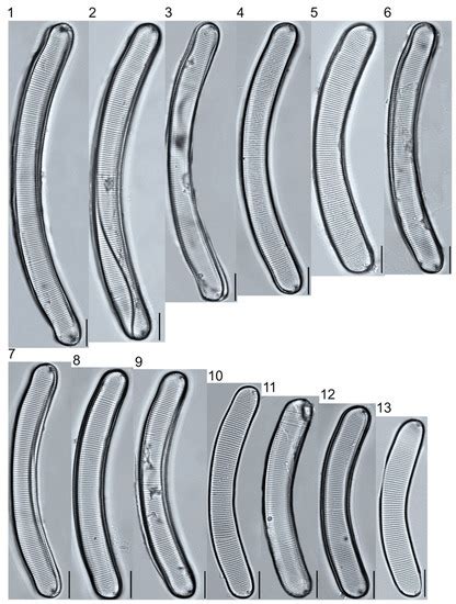 Water | Special Issue : Freshwater and/or Brackish Diatoms: Ecology and ...