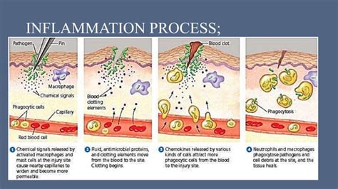 Inflammation Process Steps 的图像结果