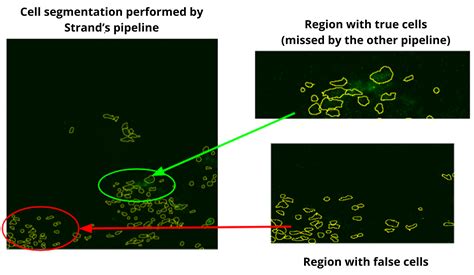 Image result for Amira Cell Segmentation Tutorial