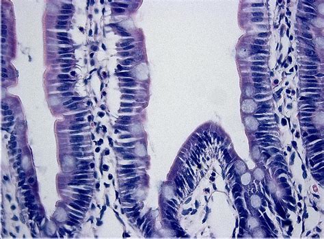 Image result for Small Intestine Epithelial Cells