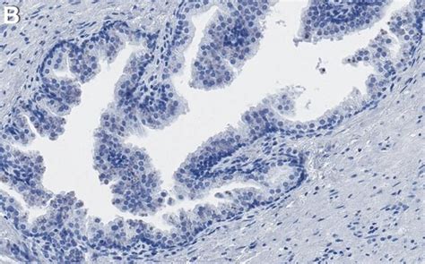 Anti-NDRG1 Antibody, clone 1C11 ZooMAb® Rabbit Monoclonal recombinant ...