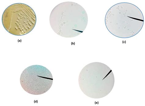 Effect of Isolation Ruminal Yeast from Ruminants on In Vitro Ruminal ...