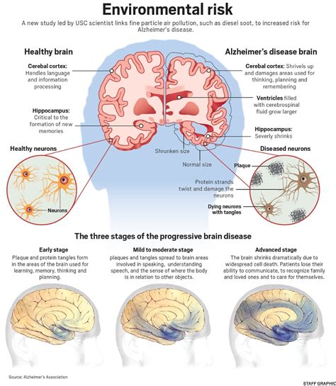 Alzheimer’s disease: Causes, Symptoms, Treatment