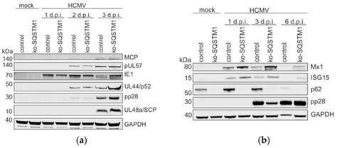 The Autophagy Receptor SQSTM1/p62 Is a Restriction Factor of HCMV Infection
