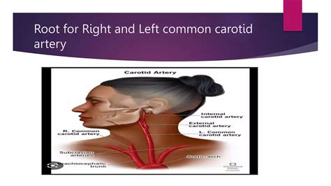 common carotid artery.pptx