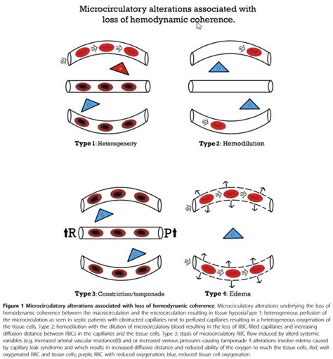 Image result for Pulse Pressure Variation EMCrit