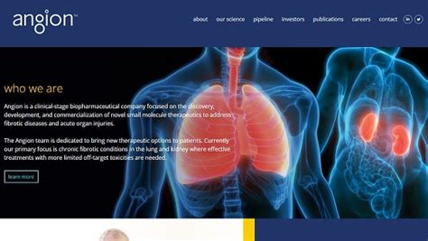 Image result for Angion Method Review