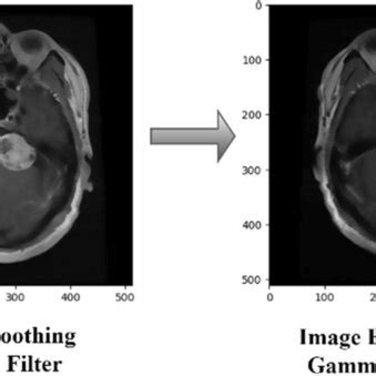 Image result for Image Preprocessing Methods