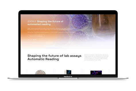 Image result for Microtechnix Scan Lab