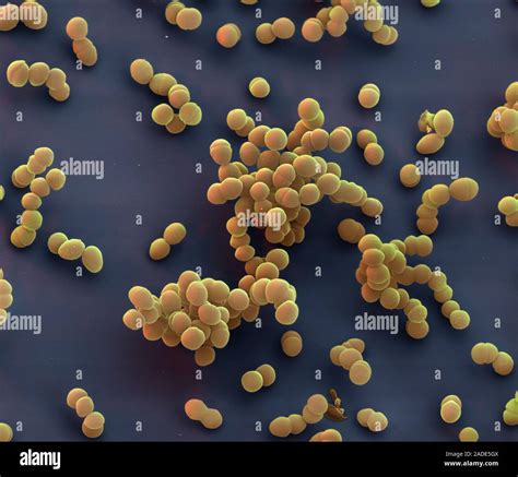 Image result for Enterococcus Faecalis Bacteria Cell Structure