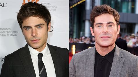 Zac Efron Then & Now: Photos Before & After Jaw Surgery - Betches