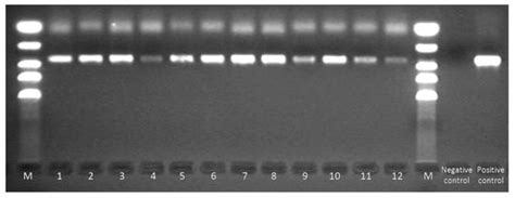 Molecular Epidemiology and Variation of the BK Polyomavirus in the ...